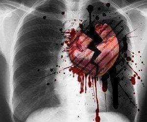 متلازمة القلب المكسور بقلم د علي أحمد جديد