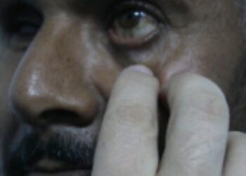 الفريق الطبي الزائر للعيون يستكمل حالات الحجر بمصحة الهرم